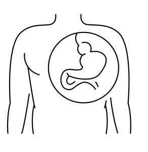 Hiatal hernias