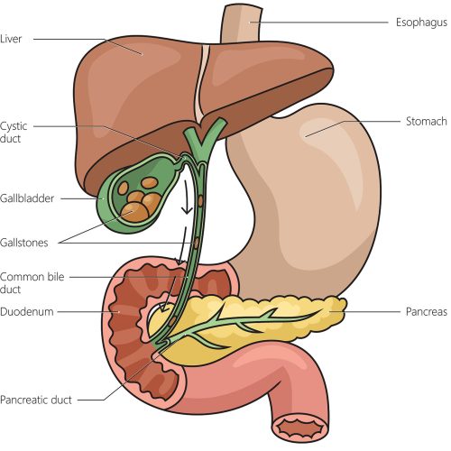 gallbladder disease